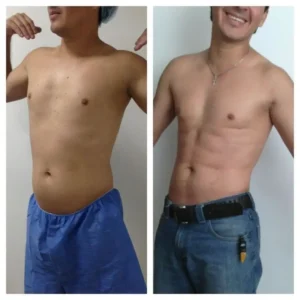 MARCACION-DE-ABDOMINALES-BOGOTA-COLOMBIA-1