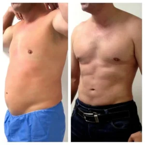 MARCACION-DE-ABDOMINALES-BOGOTA-COLOMBIA-2