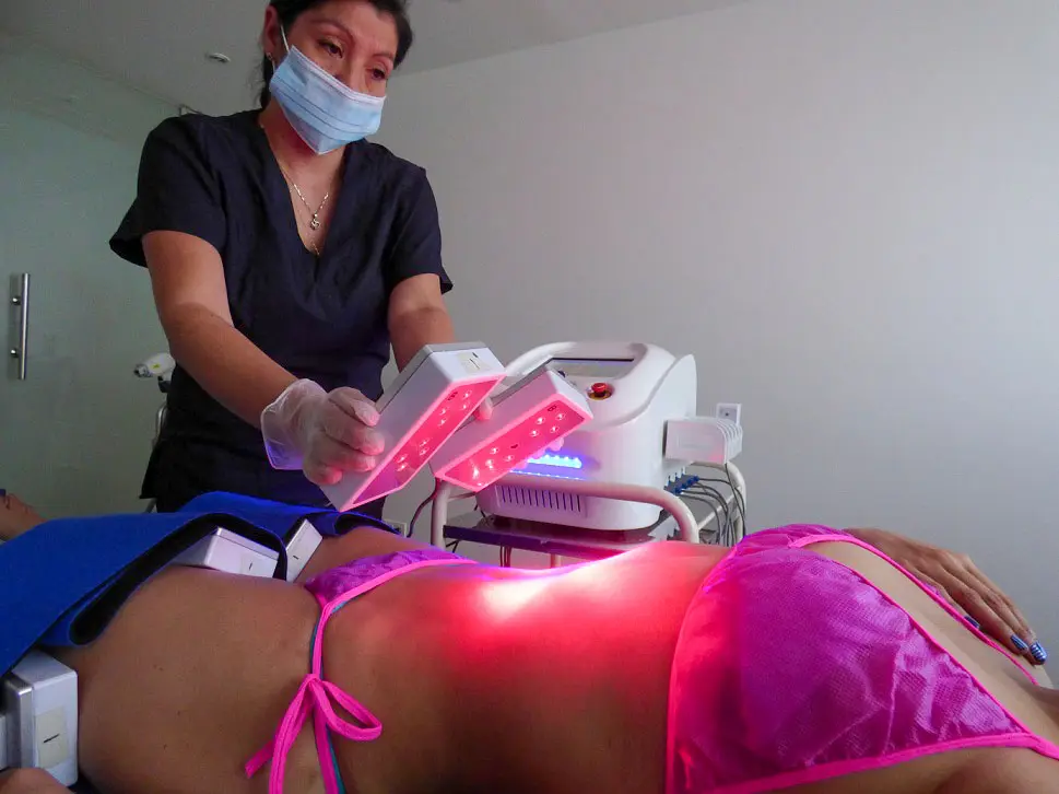 Lipólisis láser externa