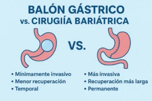 balon gastrico vs bariatrica